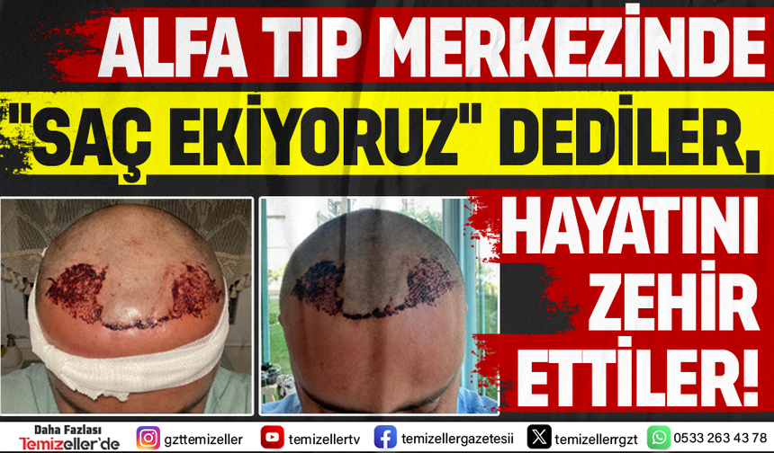 ALFA TIP MERKEZİ'NDE “SAÇ EKİYORUZ” DEDİLER, HAYATI ZEHİR ETTİLER!
